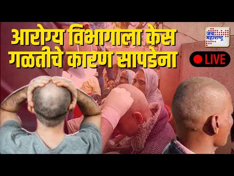 LIVE Buldhana Shegaon Hair Loss Disease | आरोग्य विभागाच्या टीमला केस गळतीचे कारण सापडेना