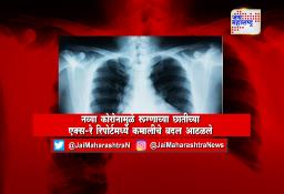 नव्या कोरोनामुळे रूग्णाच्या छातीच्या एक्स-रे रिपोर्टमध्ये कमालीचे बदल आढळले…