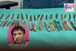 Man Swallowed 50 Objects : भयंकर! 29 चमचे, 19 टूथब्रश, 2 पेन; शस्त्रक्रीया करून काढल्या या व्यक्तीच्या पोटातून वस्तू