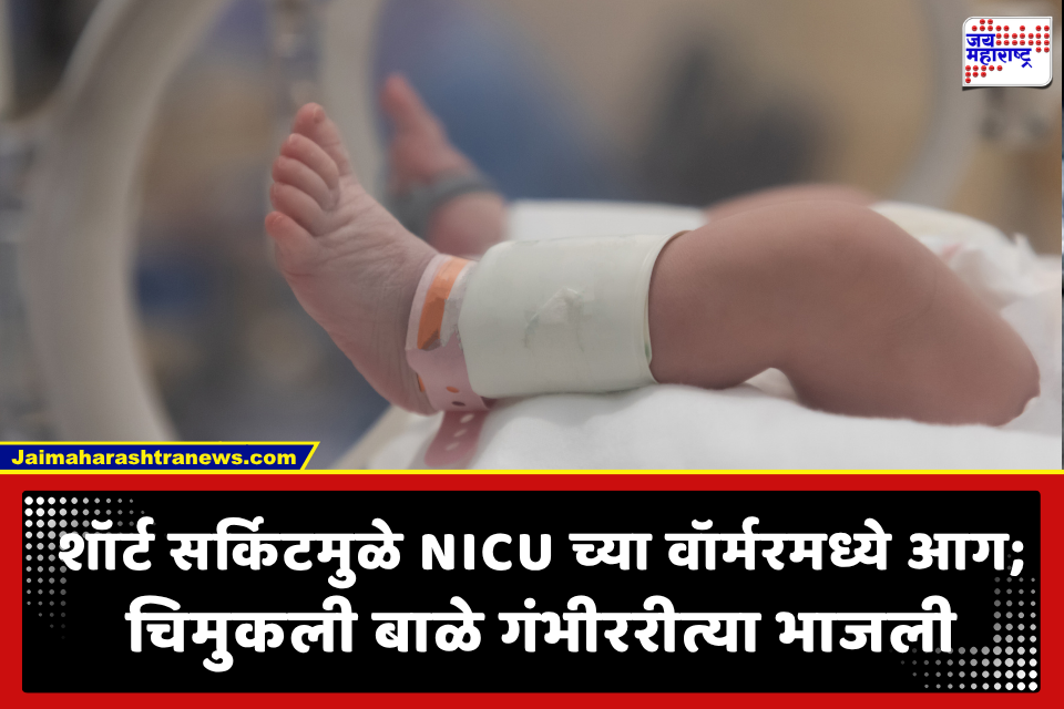मध्यरात्रीनंतर जिल्हा रुग्णालयातील NICU च्या वॉर्मरला भीषण आग; 3 नवजात बालके गंभीररीत्या भाजली