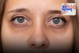 Dark Circles Remedies:  डार्क सर्कलमुळे होतोयं सौंदर्यावर परिणाम?; हा घरगुती उपाय केल्यानं डोळे दिसतील सुंदर
