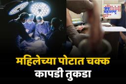 डॉक्टरांचा हलगर्जीपणा; प्रसूती दरम्यान महिलेच्या पोटात राहिला कापडी तुकडा