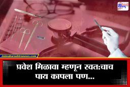 दिव्यांग कोट्यातून प्रवेशासाठी तरुणाने स्वतःचाच पाय कापला; डॉक्टर होण्याआधी स्वतःवरच केली सर्जरी, नेमकं प्रकरण काय?