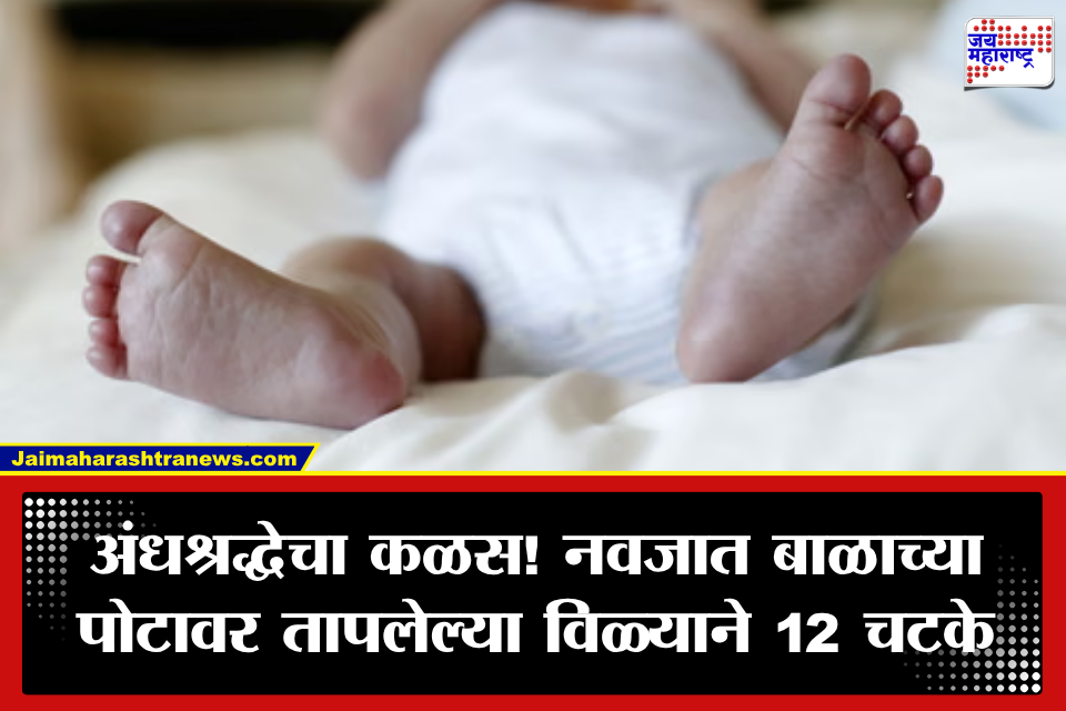 Melghat: मेळघाट हादरलं! 15 दिवसांच्या चिमुकलीच्या पोटावर 12 चटके; उपचारांच्या नावाखाली अघोरी प्रकार