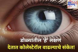डोळ्यांत दिसणारी ‘ही’ 5 लक्षणं सांगतात तुमच्या शरीरातील कोलेस्टेरॉलची पातळी