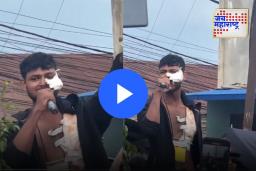 Nepal Viral Video: चेहरा अन् छातीवर जखमा असूनही थेट आंदोलनात, नेपाळच्या तरुणाचा व्हिडीओ व्हायरल