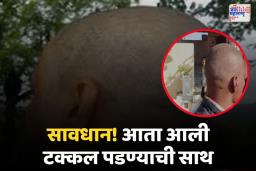 सावधान! आता आली टक्कल पडण्याची साथ