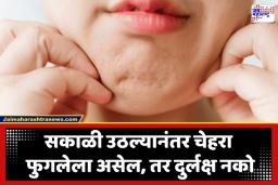 How To Reduce Puffy Face: सकाळी उठल्यावर चेहरा फुगलेला दिसतोय? सावधान! हे असू शकतं ‘या’ गंभीर आजाराचं लक्षण