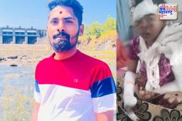 मित्राच्या साहाय्याने नवऱ्याने केला बायकोवर स्क्रू ड्रायव्हरने हल्ला– कपडे धुताना घडलेलं भयानक वास्तव