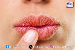 हिवाळ्यात ओठांची कशी घ्याल काळजी? काय आहेत उपाय?