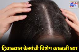 Winter Dandruff Problems: हिवाळ्यात केसांमध्ये कोंडा वाढलाय? ‘हे’ 5 घरगुती उपाय करतील त्रासावर नियंत्रण आणि देतील नैसर्गिक चमक