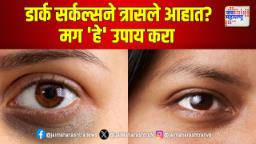 डार्क सर्कल्सने त्रासले आहात? मग ‘हे’ उपाय करा