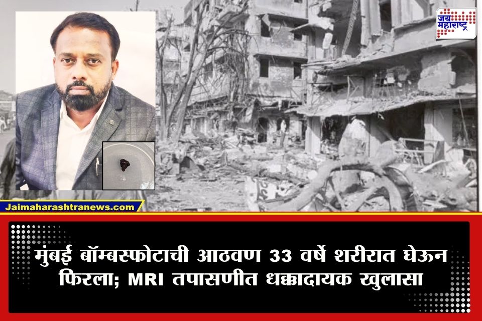 ब्रेन स्ट्रोकच्या उपचारादरम्यान उलगडलं 33 वर्षांचं गूढ; MRIमध्ये सापडलं..;  1993च्या बॉम्बस्फोटाशी थेट कनेक्शन समोर