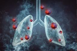 World Cancer Day : धूम्रपान न करणाऱ्यांमध्ये फुफ्फुसांच्या कर्करोगाचा धोका वाढला! ‘हे’ आहे भयावह स्थितीचं कारण