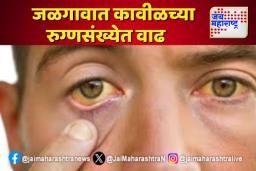 जळगावात वाढत्या कावीळचं संकट अशी घ्या काळजी