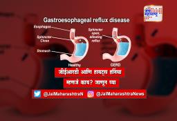 जीईआरडी आणि हायट्स हर्निया म्हणजे काय? जाणून घ्या